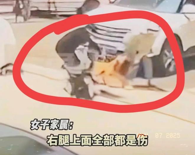 ！右腿打了13针未找到主人回应开元棋牌女子推婴儿车遭恶狗撕咬(图6)